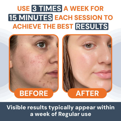 Face Massager - Anti-Aging, Skin Tightening & Wrinkle Reduction Device with 7 Colours & 3 Modes